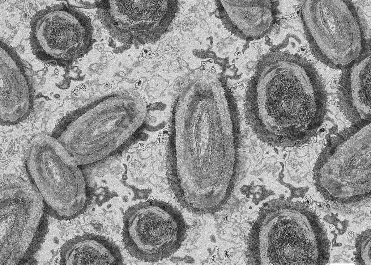 microscopic image of monkeypox virus